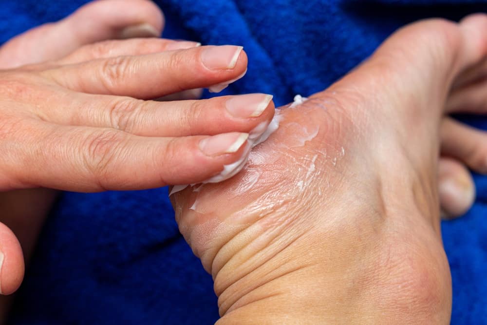 best diabetic foot creams